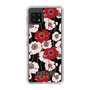 スリムプロテクションケース［ ANNA SUI - ポピー ］