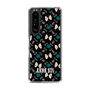 スリムプロテクションケース［ ANNA SUI - バタフライ ］