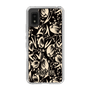 スリムプロテクションケース［ ANNA SUI - チューリップ ］