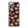 スリムプロテクションケース［ ANNA SUI - ポウジーズ ］