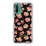 スリムプロテクションケース［ ANNA SUI - ポウジーズ ］