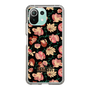 スリムプロテクションケース［ ANNA SUI - ポウジーズ ］