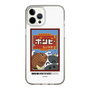 スリムプロテクションケース［ 『ダンダダン』 - ポンピ― ］