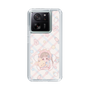スリムプロテクションケース［ ぽちぇ - baby girl ］