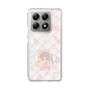 スリムプロテクションケース［ ぽちぇ - baby girl ］